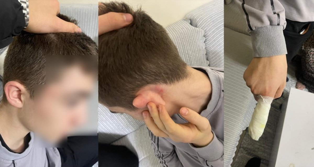 Hırsızlık yaptı sandılar, 14 yaşındaki çocuğu tekme tokat dövdüler